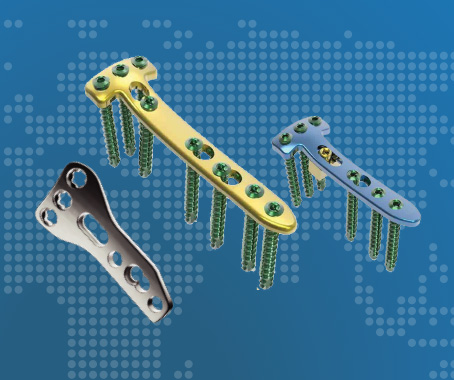 Proksimal Tibia Yüksek Osteotomi Anatomik Plak